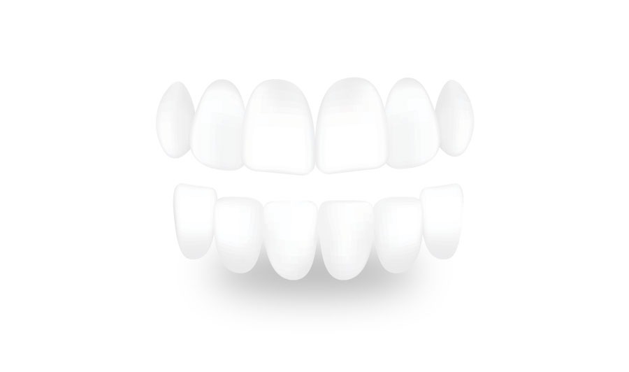 level two teeth image